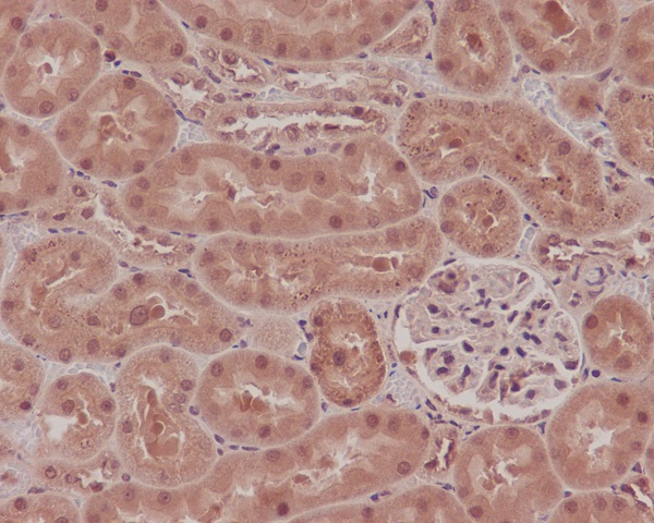 IHC - Anti-NOX4 Rabbit Monoclonal Antibody ABO13341